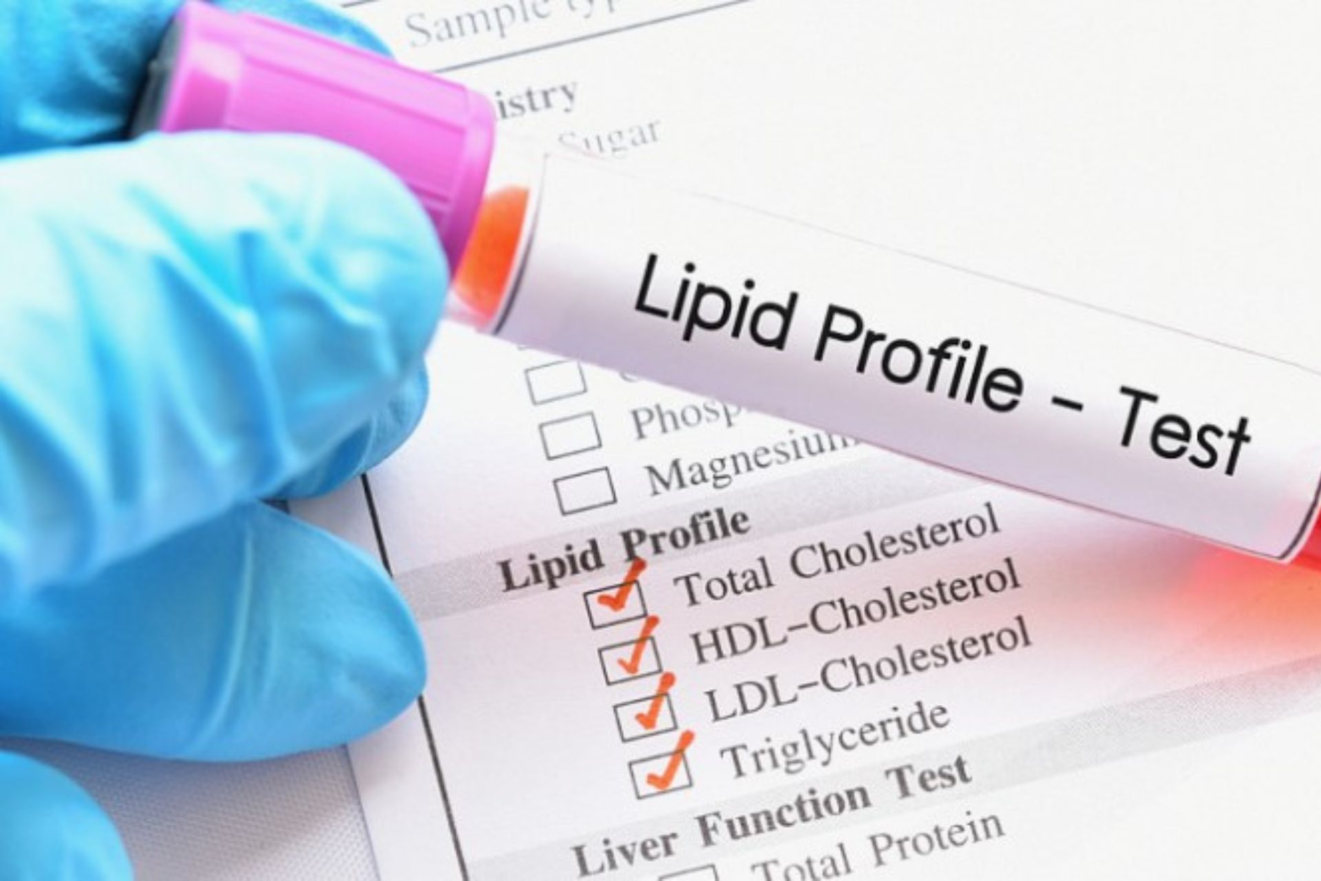 Lipid profile test price